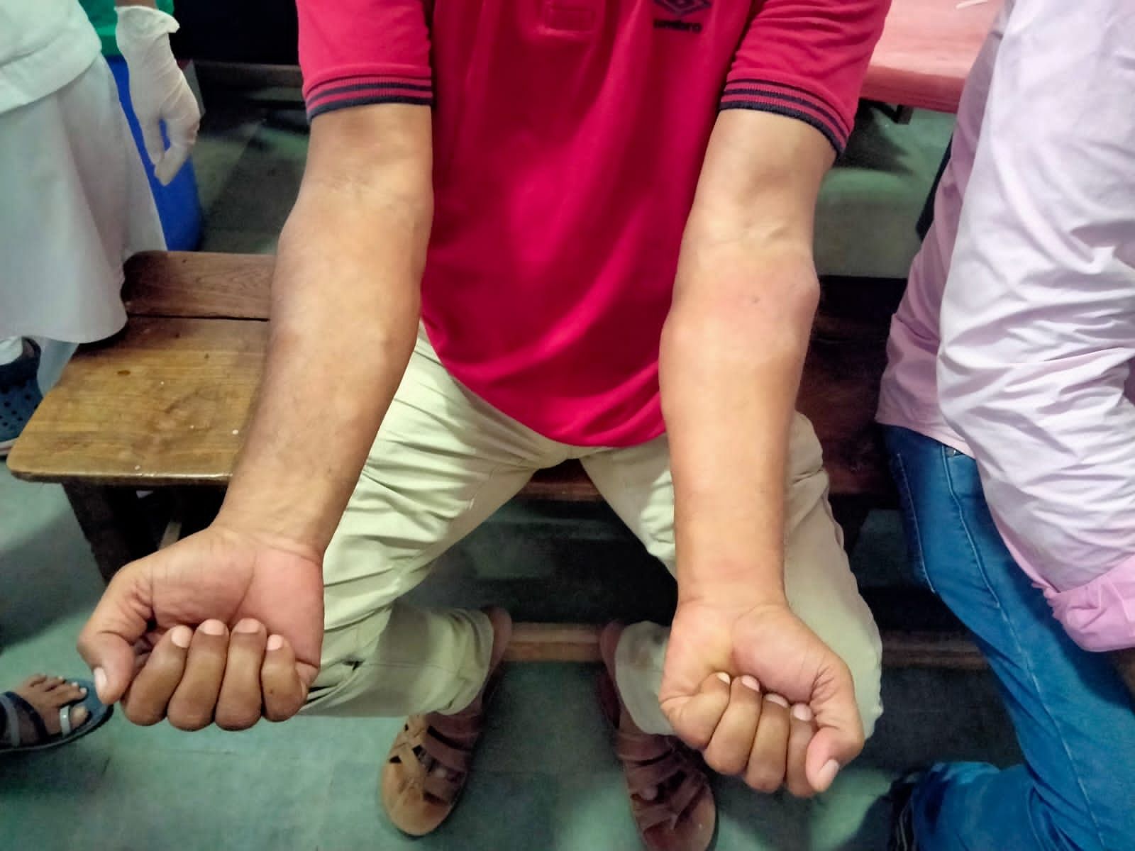 ಹುಬ್ಬಳ್ಳಿ: ಎಸ್ಸೆಸ್ಸೆಲ್ಸಿ ವಿದ್ಯಾರ್ಥಿಗಳು, ಪಾಲಕರ ಮೇಲೆ ಹೆಜ್ಜೇನು ದಾಳಿ